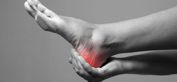 Neuropatía Diabética